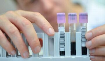 Antidoping: nuova lista delle sostanze proibite 2022